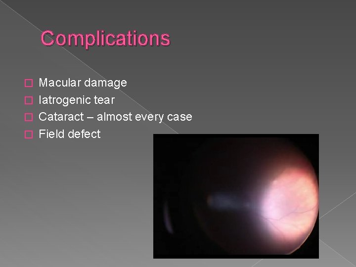 Complications Macular damage � Iatrogenic tear � Cataract – almost every case � Field