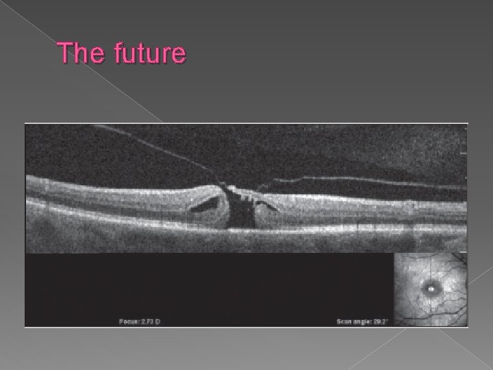 The future 