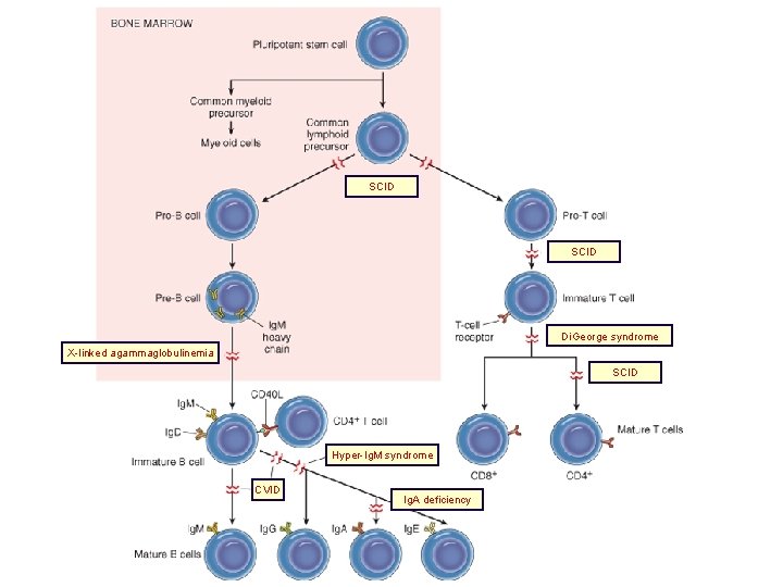 SCID Di. George syndrome X-linked agammaglobulinemia SCID Hyper-Ig. M syndrome CVID Ig. A deficiency