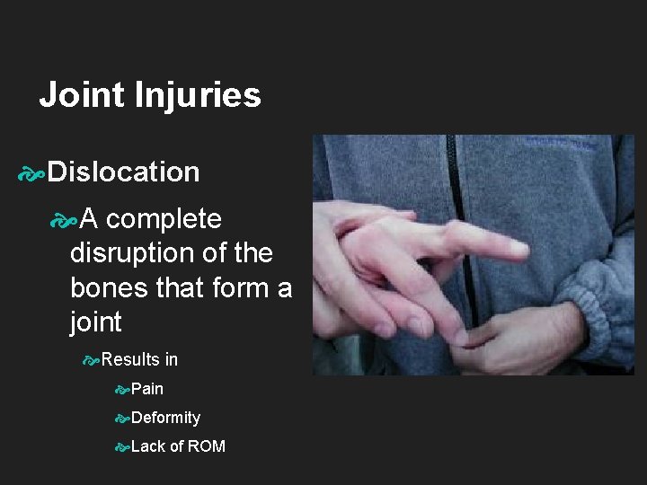 Joint Injuries Dislocation A complete disruption of the bones that form a joint Results