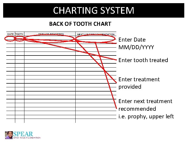 CHARTING SYSTEM BACK OF TOOTH CHART Enter Date MM/DD/YYYY Enter tooth treated Enter treatment