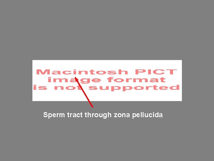 Sperm tract through zona pellucida 