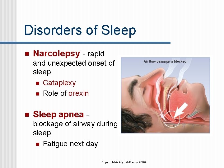 Disorders of Sleep n Narcolepsy - rapid and unexpected onset of sleep n Cataplexy Disorders of Sleep n Narcolepsy - rapid and unexpected onset of sleep n Cataplexy