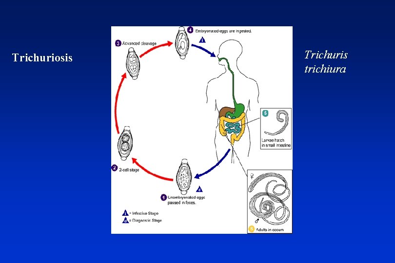 Trichuriosis Trichuris trichiura 