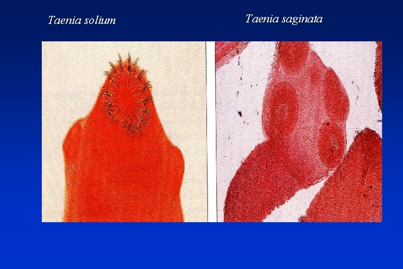 Taenia solium Taenia saginata 