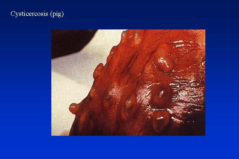 Cysticercosis (pig) 