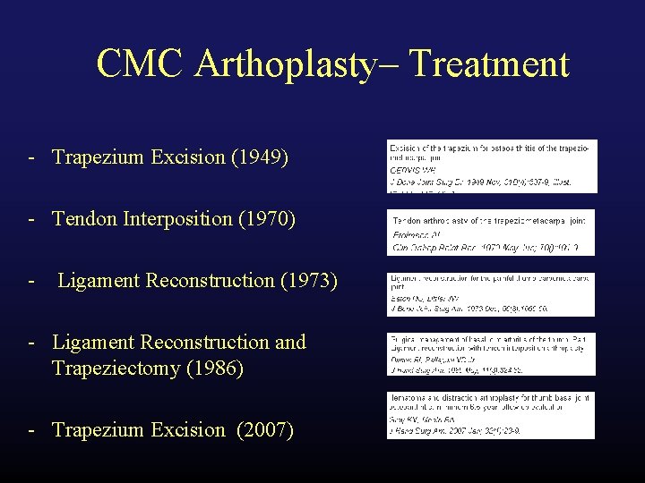 CMC Arthoplasty– Treatment - Trapezium Excision (1949) - Tendon Interposition (1970) - Ligament Reconstruction