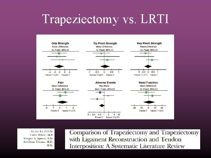 Trapeziectomy vs. LRTI 