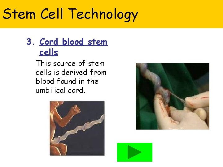 Stem Cell Technology 3. Cord blood stem cells This source of stem cells is
