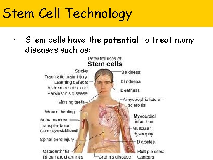 Stem Cell Technology • Stem cells have the potential to treat many diseases such