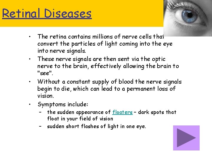 Retinal Diseases • • The retina contains millions of nerve cells that convert the