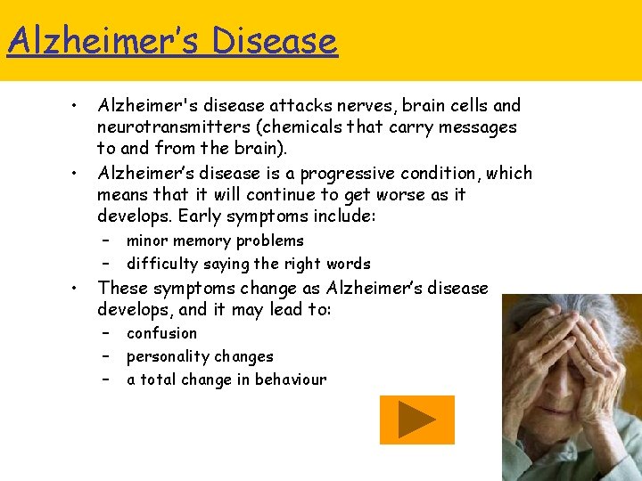 Alzheimer’s Disease • • Alzheimer's disease attacks nerves, brain cells and neurotransmitters (chemicals that