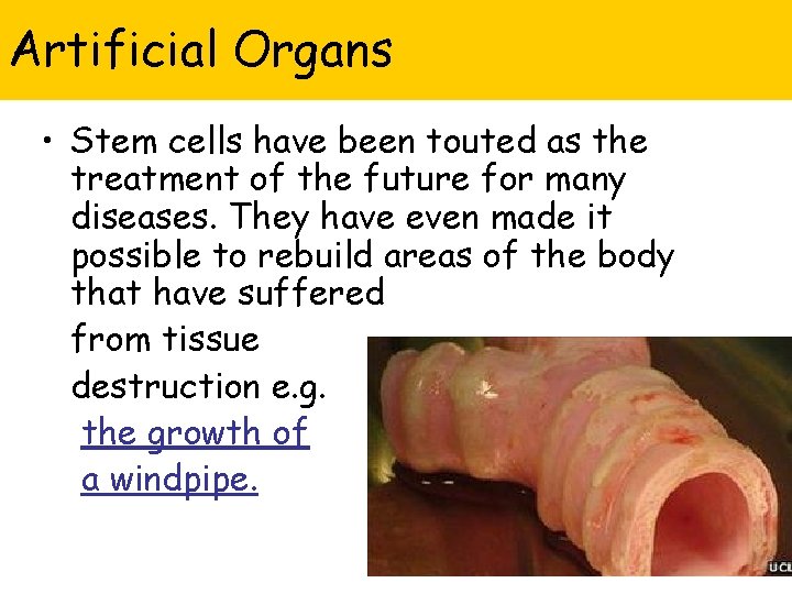 Artificial Organs • Stem cells have been touted as the treatment of the future