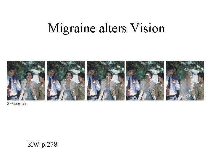 Migraine alters Vision KW p. 278 