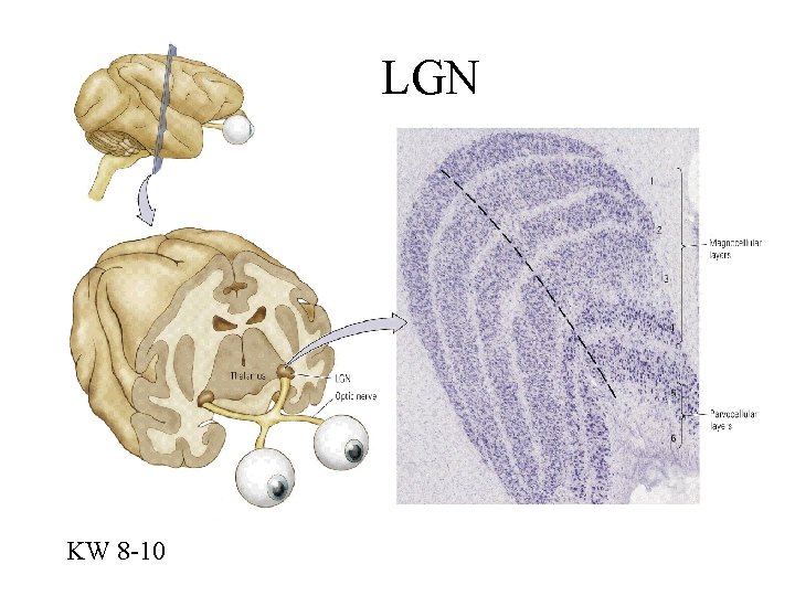 LGN KW 8 -10 