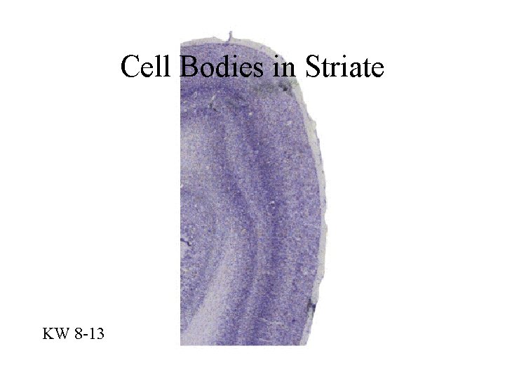 Cell Bodies in Striate KW 8 -13 