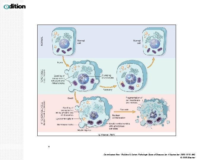 n Downloaded from: Robbins & Cotran Pathologic Basis of Disease (on 4 September 2005