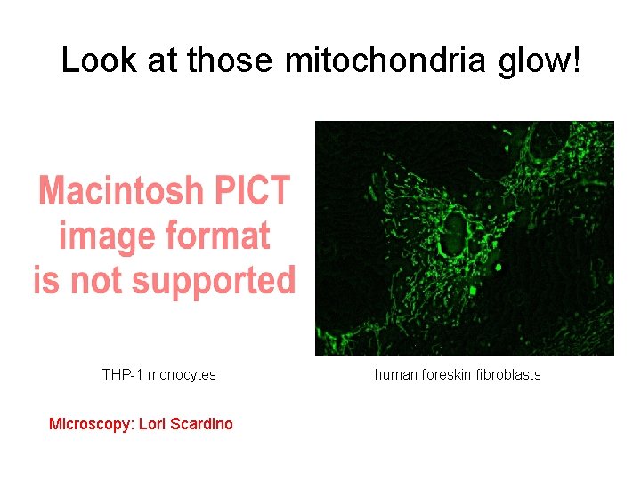 Look at those mitochondria glow! THP-1 monocytes Microscopy: Lori Scardino human foreskin fibroblasts 