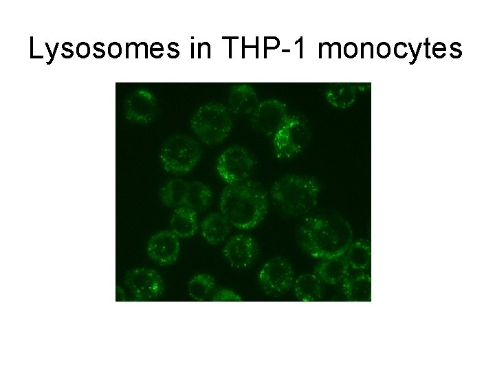 Lysosomes in THP-1 monocytes 