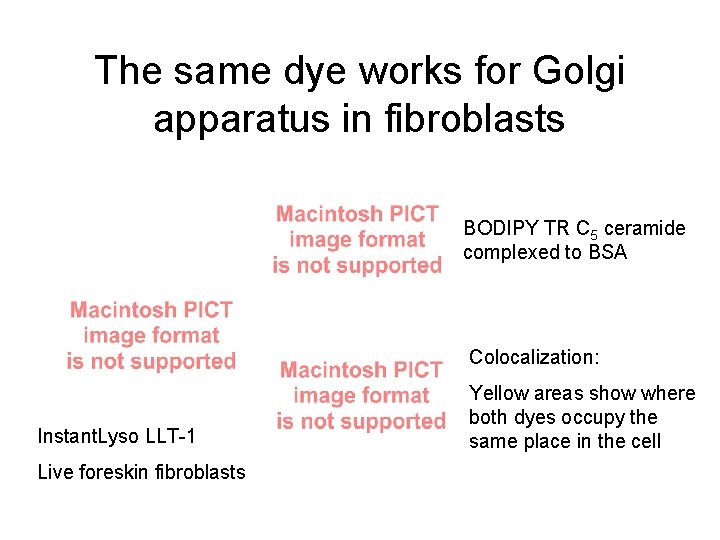 The same dye works for Golgi apparatus in fibroblasts BODIPY TR C 5 ceramide