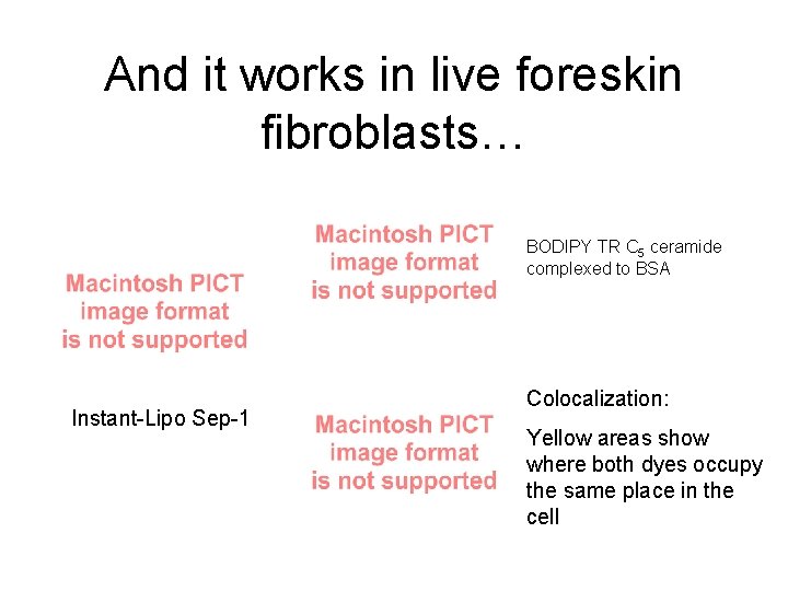 And it works in live foreskin fibroblasts… BODIPY TR C 5 ceramide complexed to