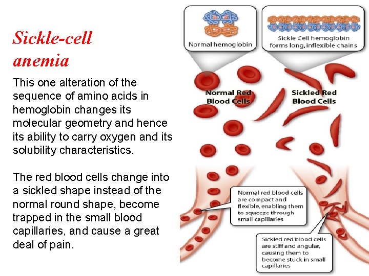 Sickle-cell anemia This one alteration of the sequence of amino acids in hemoglobin changes