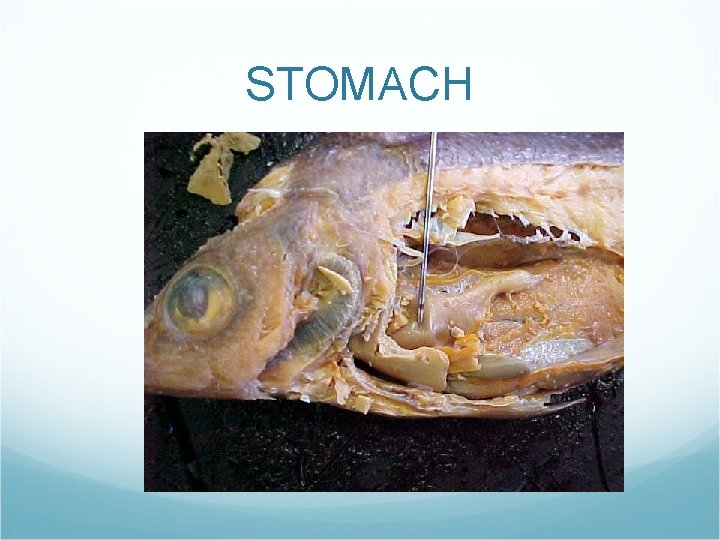 STOMACH STOMACH