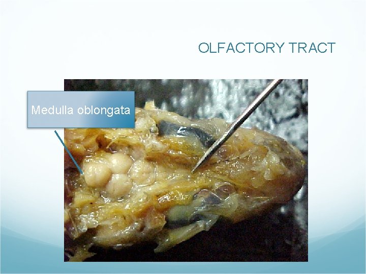 OLFACTORY TRACT Medulla oblongata OLFACTORY TRACT Medulla oblongata
