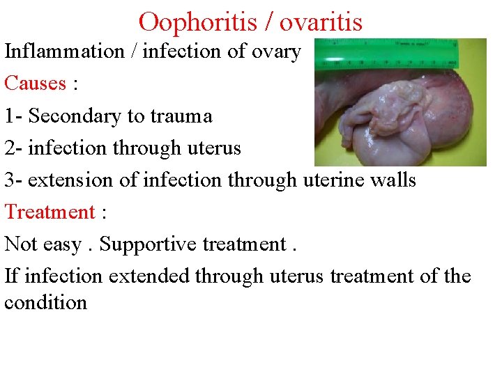 Oophoritis / ovaritis Inflammation / infection of ovary Causes : 1 - Secondary to