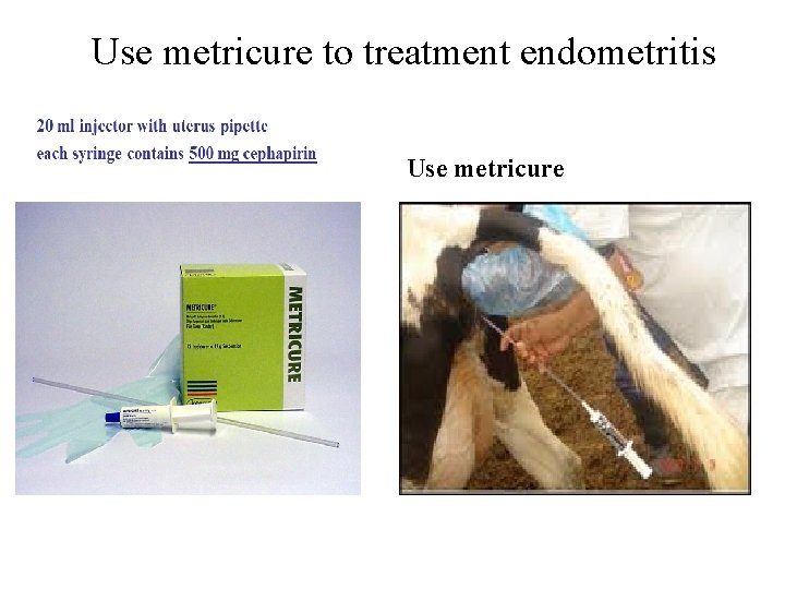 Use metricure to treatment endometritis Use metricure 