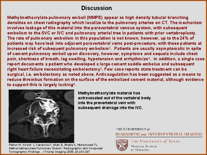 Discussion Methylmethacrylate pulmonary emboli (MMPE) appear as high density tubular branching densities on chest