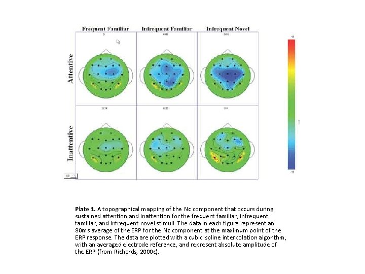 Plate 1. A topographical mapping of the Nc component that occurs during sustained attention