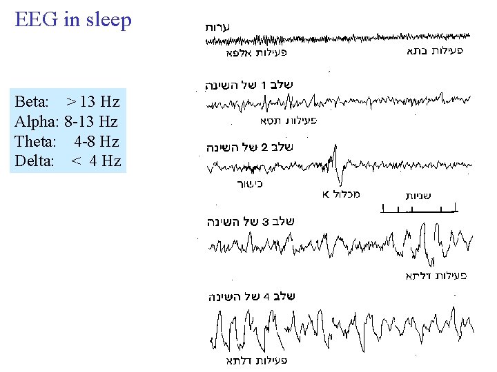 EEG in sleep Beta: > 13 Hz Alpha: 8 -13 Hz Theta: 4 -8