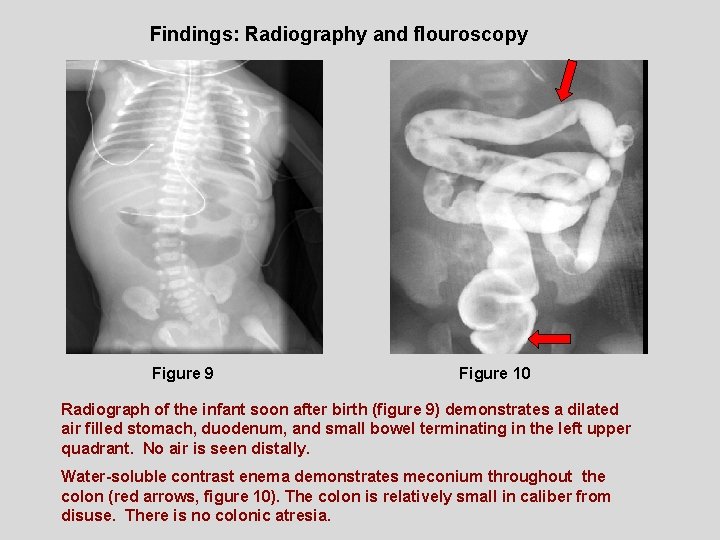 Radiological Category Pediatric Radiology Principal Modality 1 Ultrasound