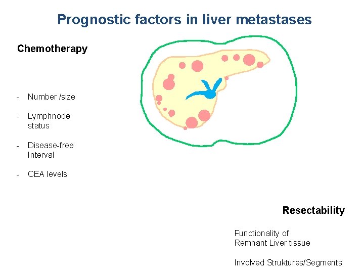 Prognostic factors in liver metastases Technical Chemotherapy - Number /size - Lymphnode status -