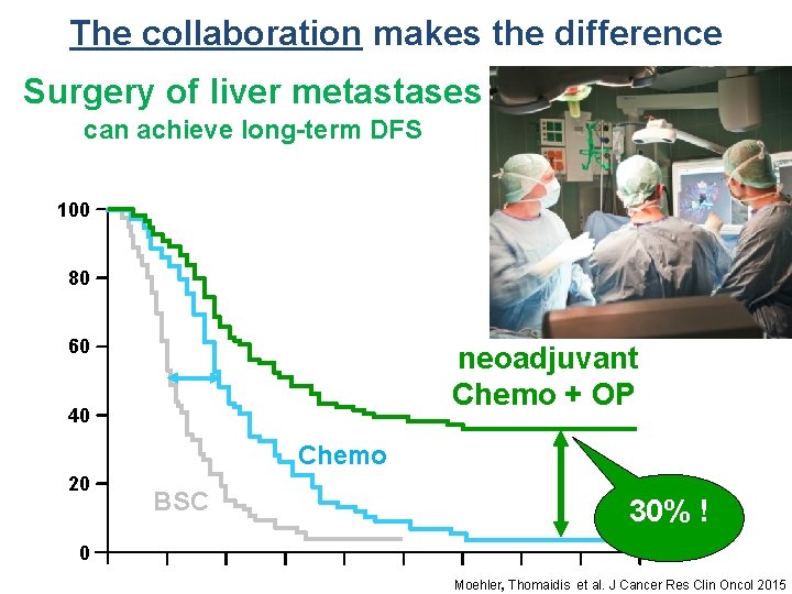 The collaboration makes the difference Surgery of liver metastases can achieve long-term DFS 100