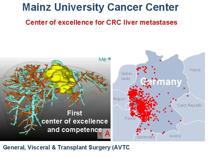 Mainz University Cancer Center of excellence for CRC liver metastases First center of excellence