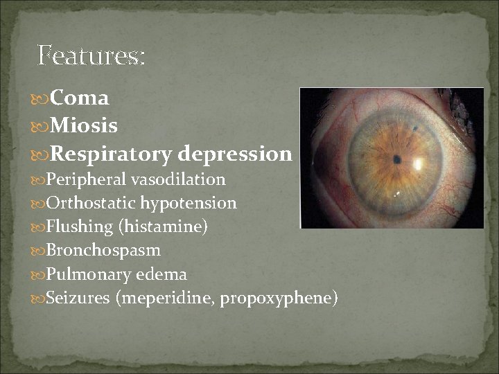 Features: Coma Miosis Respiratory depression Peripheral vasodilation Orthostatic hypotension Flushing (histamine) Bronchospasm Pulmonary edema