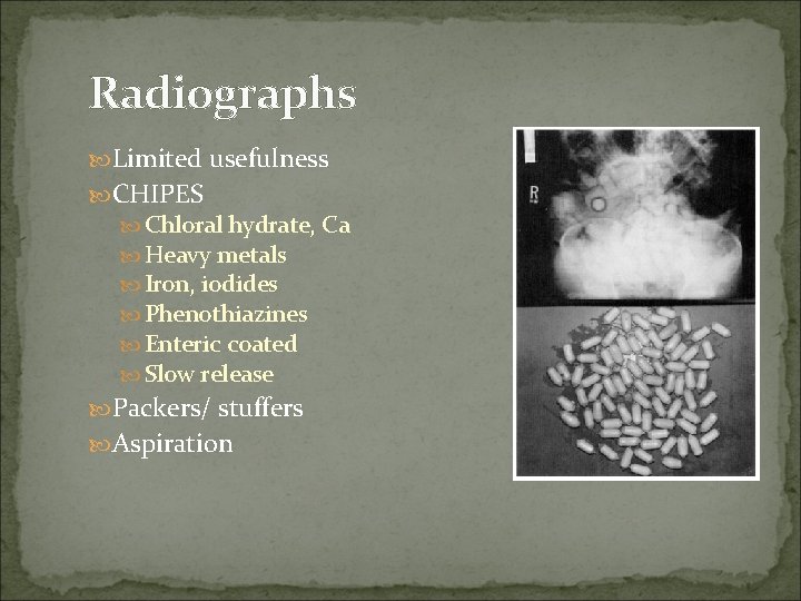 Radiographs Limited usefulness CHIPES Chloral hydrate, Ca Heavy metals Iron, iodides Phenothiazines Enteric coated