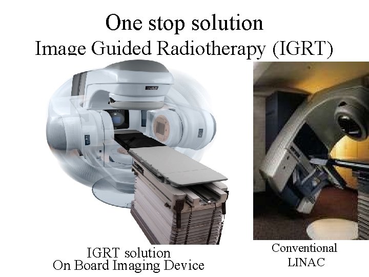 One stop solution Image Guided Radiotherapy (IGRT) IGRT solution On Board Imaging Device Conventional