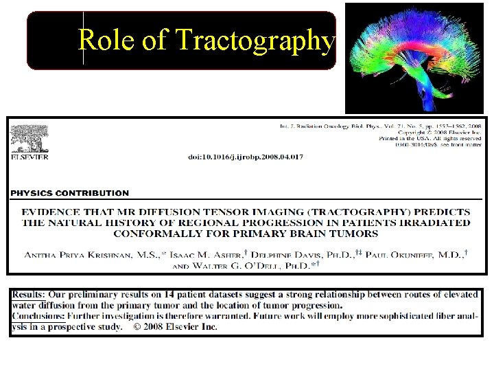 Role of Tractography 