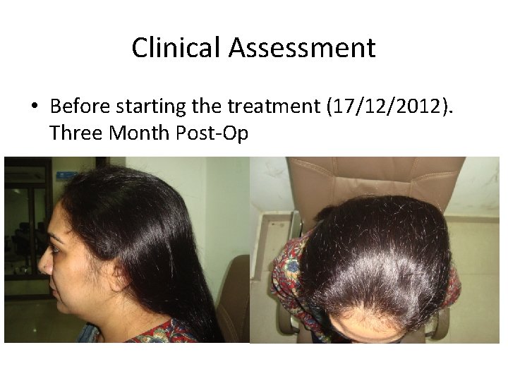 Clinical Assessment • Before starting the treatment (17/12/2012). Three Month Post-Op 