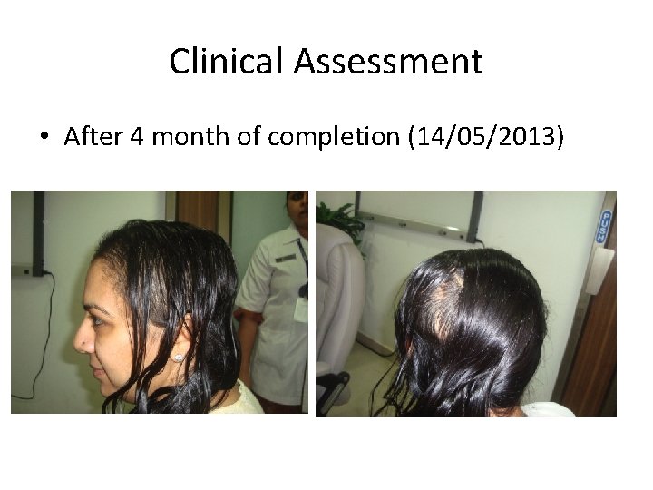 Clinical Assessment • After 4 month of completion (14/05/2013) 
