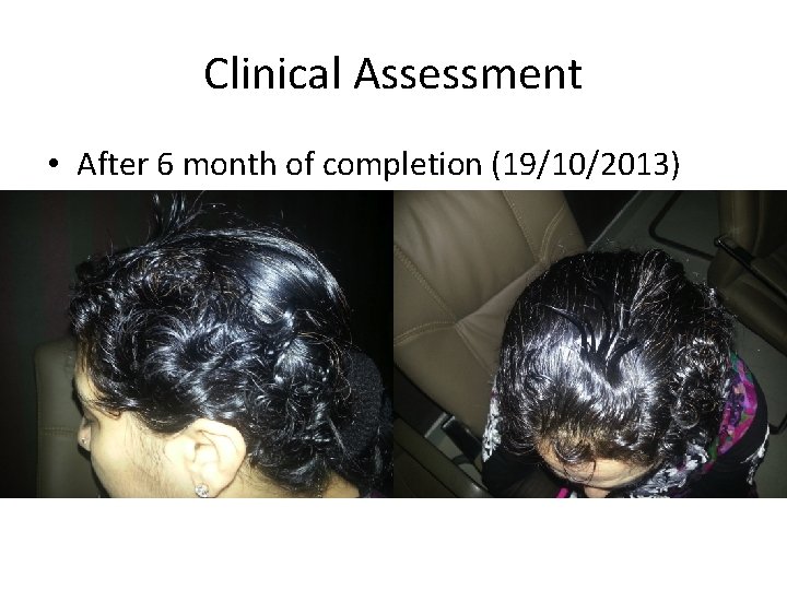 Clinical Assessment • After 6 month of completion (19/10/2013) 