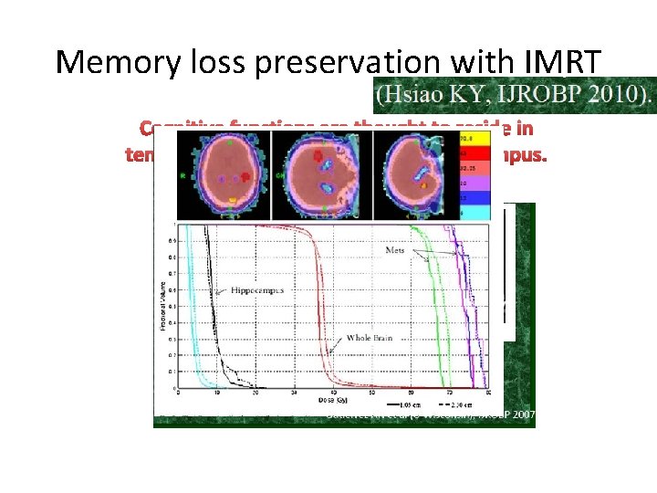 Memory loss preservation with IMRT Cognitive functions are thought to reside in temporal lobes