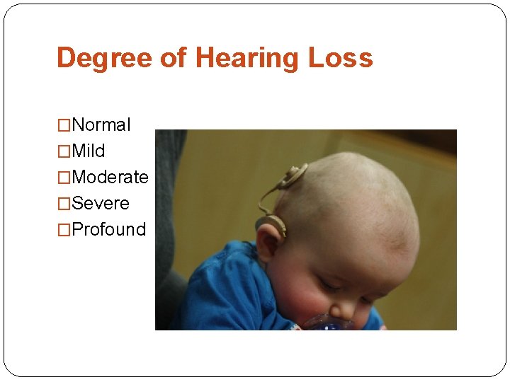 Degree of Hearing Loss �Normal �Mild �Moderate �Severe �Profound 