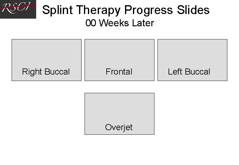 Splint Therapy Progress Slides 00 Weeks Later Right Buccal Frontal Overjet Left Buccal Splint Therapy Progress Slides 00 Weeks Later Right Buccal Frontal Overjet Left Buccal