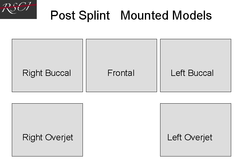Post Splint Mounted Models Right Buccal Right Overjet Frontal Left Buccal Left Overjet Post Splint Mounted Models Right Buccal Right Overjet Frontal Left Buccal Left Overjet