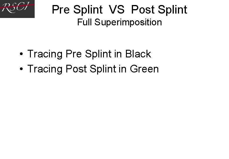 Pre Splint VS Post Splint Full Superimposition • Tracing Pre Splint in Black • Pre Splint VS Post Splint Full Superimposition • Tracing Pre Splint in Black •