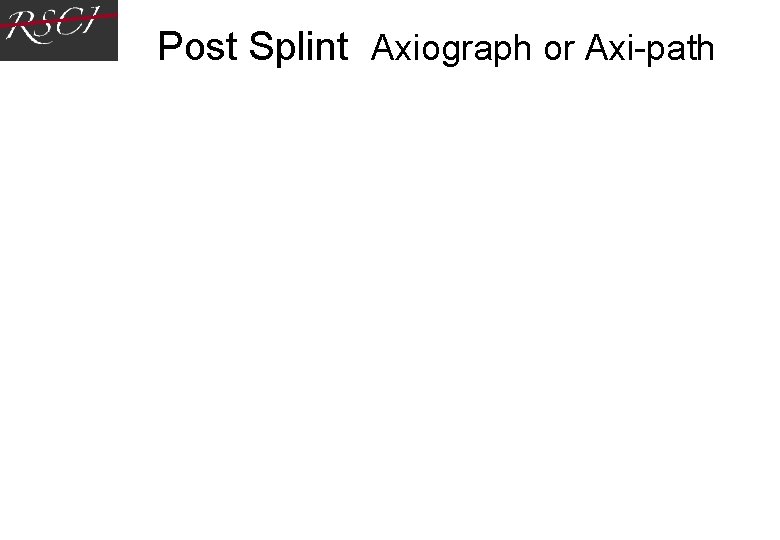 Post Splint Axiograph or Axi-path Post Splint Axiograph or Axi-path